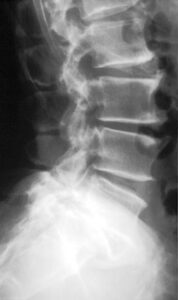 Slijtage - Chiropractor Lochristi